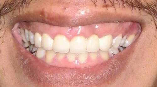 cosmetic6after